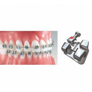 Bionic Bracket – Bicuspid with Offset (10/pk)