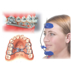 Intraoral / Extraoral Appliances Intraoral / Extraoral Appliances