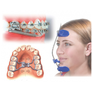 Intraoral / Extraoral Appliances