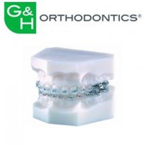 Cosmetic Brackets - Composite Brackets