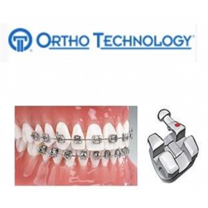 Ortho Technology Brackets   Metal / Marquis Brackets Stainless Steel Bracket System
