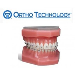 Ortho Technology Brackets – Aesthetic / Sensation Active Ceramic Slb Bracket System
