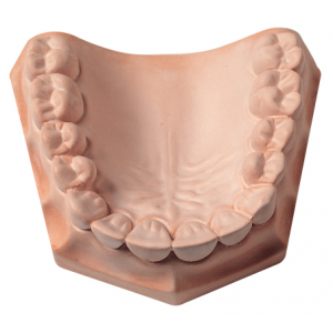 Snap-Stone Type IV Pink