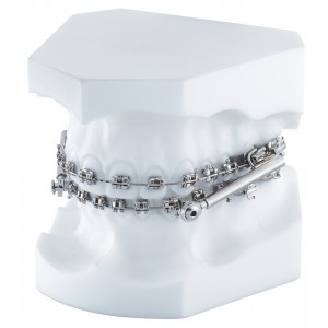 Orthodontic Demonstration Model Equilibrium ® 2/Sus ² - 1 piece