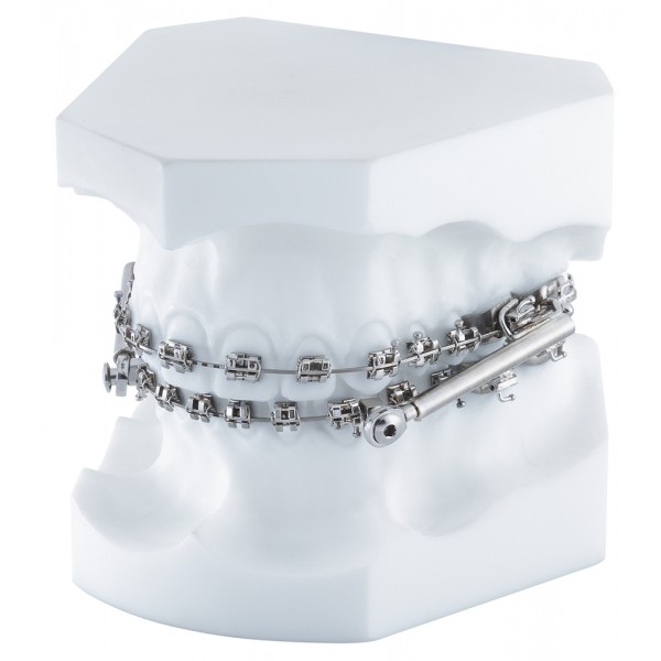Orthodontic Demonstration Model Equilibrium ® 2/Sus ² - 1 piece