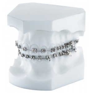 Orthodontic Demonstration Model Equilibrium ® Mini/Equilibrium ® 2 - 1 piece