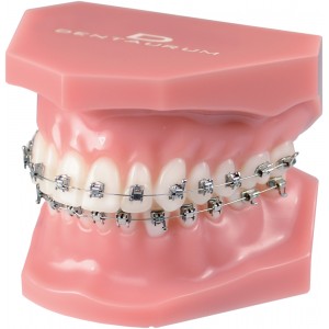 Orthodontic Demonstration Model Discovery ® Sl 2.0 - 1 piece