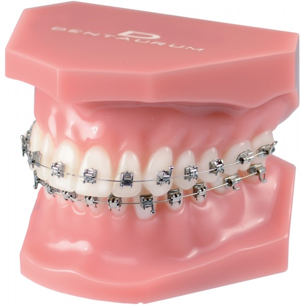 Orthodontic Demonstration Model Discovery ® Sl 2.0 - 1 piece