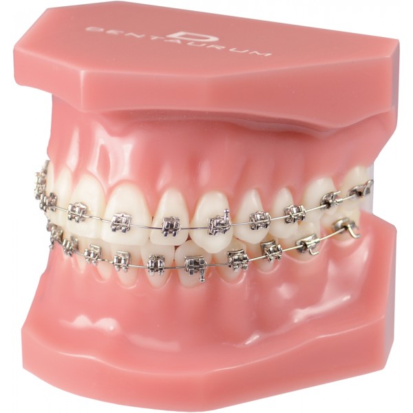 Orthodontic Demonstration Model Discovery ® Smart - 1 piece