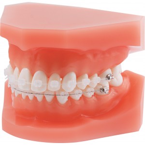 Orthodontic Demonstration Model Discovery ® Pearl - Roth - 1 piece