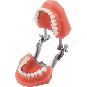 Orthodontic Demonstration Model Discovery ® Delight - 1 piece