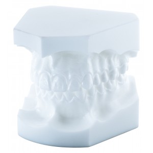 Orthodontic Study Model, Angle Class I - 1 piece