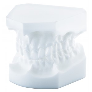 Orthodontic Study Model, Angle Class Ii/2 - 1 piece