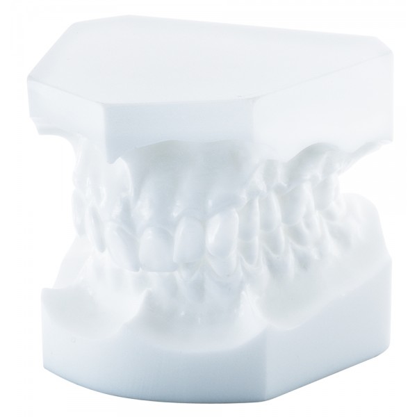 Orthodontic Study Model, Angle Class Ii/2 - 1 piece