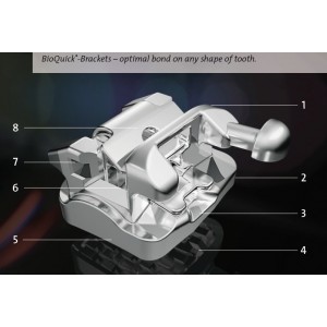 1st &2nd Molar with Hook - Distal - BioQuick - Active Self-Ligating Brackets - Roncone Prescription