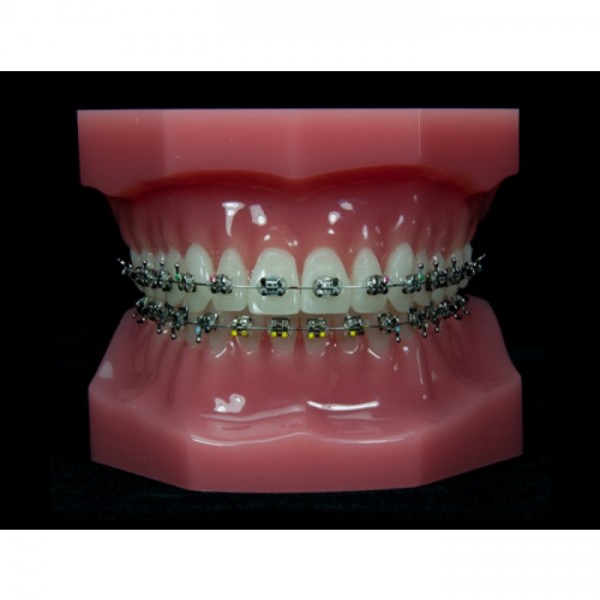 Custom Typodont Model