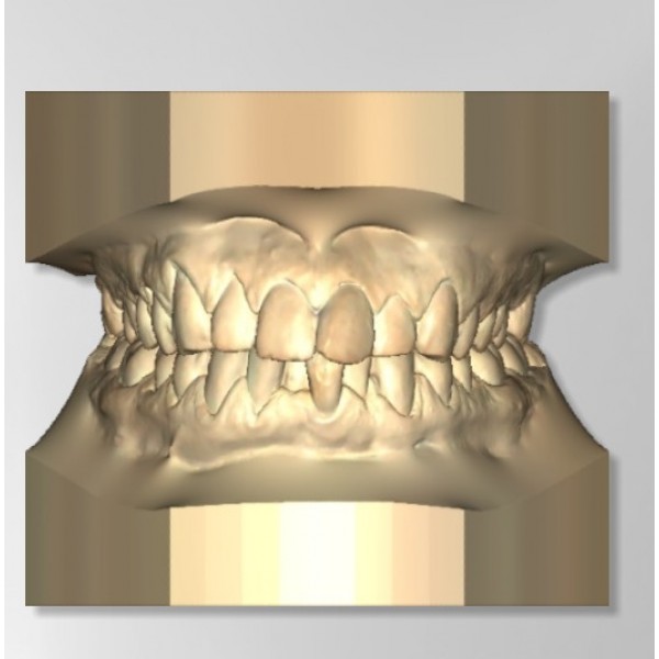 Maestro 3D Dental Studio - Ortho Studio Configuration A