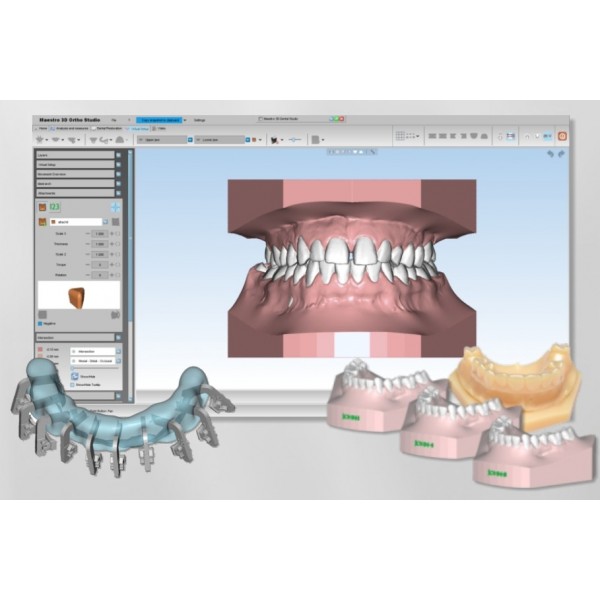 Maestro 3D Dental Studio - Ortho Studio Configuration A