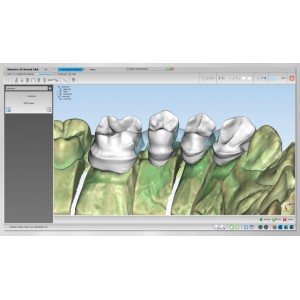 Maestro 3D Dental Studio - Dental CAD / Dental Restoration (dental restoration module)