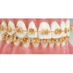 24K Gold .022 Roth Cases (20 Brackets) - Modern Arch Orthodontic Supplies