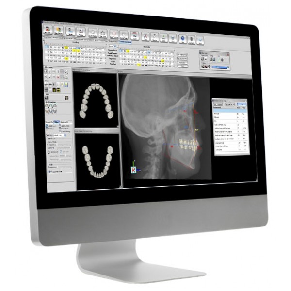 Ortho Insight 3D® - Aligner Design and Fabrication Software