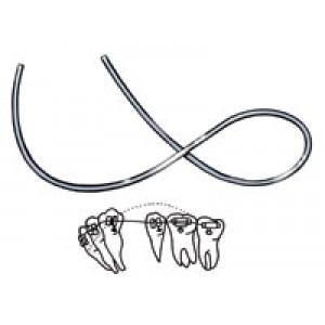 Reverse Curve Nickel Titanium Archwires