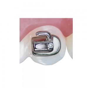 Quick-Fit Bondable Buccal Tubes