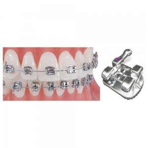 Pinnacle Stainless Steel Brackets
