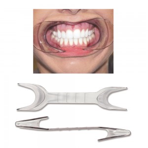 Photo Cheek Retractors Double Ended – Cold Sterilizable 1/pk