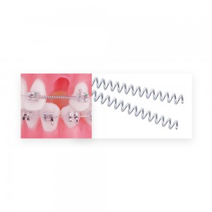 TruFlex Nickel Titanium Open Coil Springs Lengths