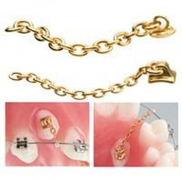 Eruption Appliance with Large Traction Chain