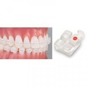 PURE® Brackets - Ultimate in Crystal Clear Aesthetics