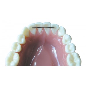 Lingual Retainer Wire .010 x .029, 6" lengths (10 ct)
