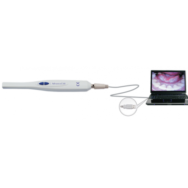 Advance CAM Intraoral Camera USB PKG (Corded Only)