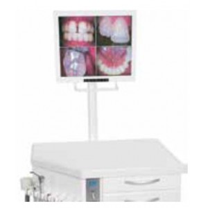Mirage - Orthodontic Package Optionals