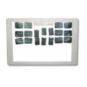 Super Thin LED X-Ray Viewer Optionals