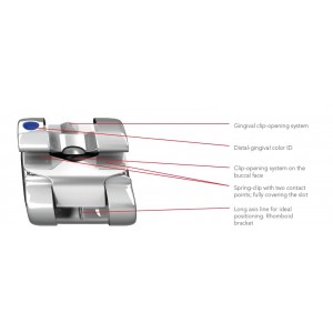 Experience Self-ligating - Metal; Roth Type .020"x .028" - Maxillary