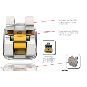 Experience Self-Ligating Bracket System