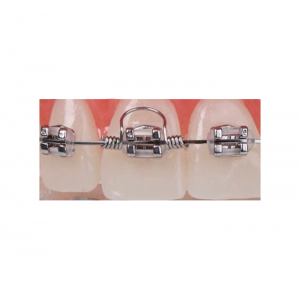 Orthodontic Torquing Coil Springs 10 pcs