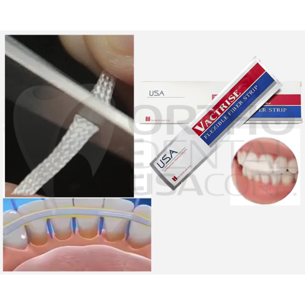 (ONE) Fiber Splint Glass Flexible Strip Bonding Strips Retainer
