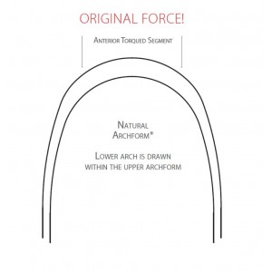 S.E.T.™ Anterior Pre-Torqued Nickel Titanium Archwire (5ct)