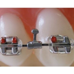 Ortho Specialties Gold Tone Hooks (20 ct)