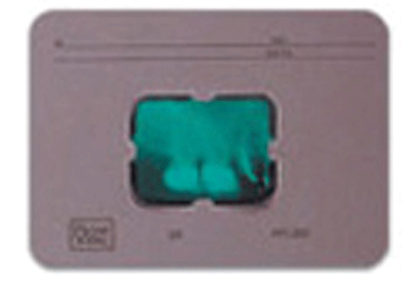 Rayさん専用 Runyes RAY98(P) Portable Dental X-Ray Camera Handheld Dental
